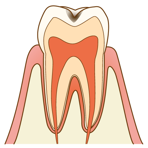 c1